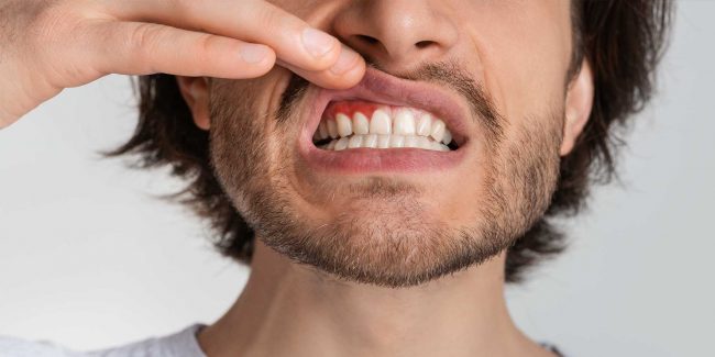 The-Surprising-Link-Between-Gum-Disease-and-Heart-Health The Surprising Link Between Gum Disease and Heart Health | Bonacci Periodontal Implants